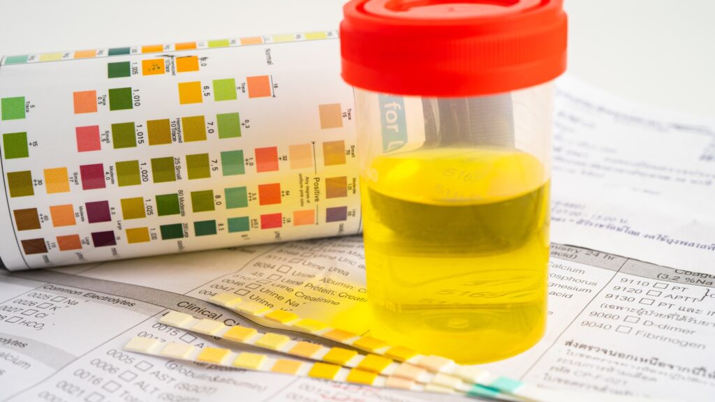 Blood and Urine Testing